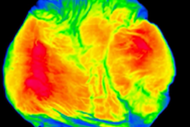 エアバックの安全性評価【高速計測】